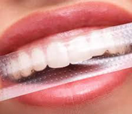 1761899036293517.jpg Teeth Whitening Strips.jpg